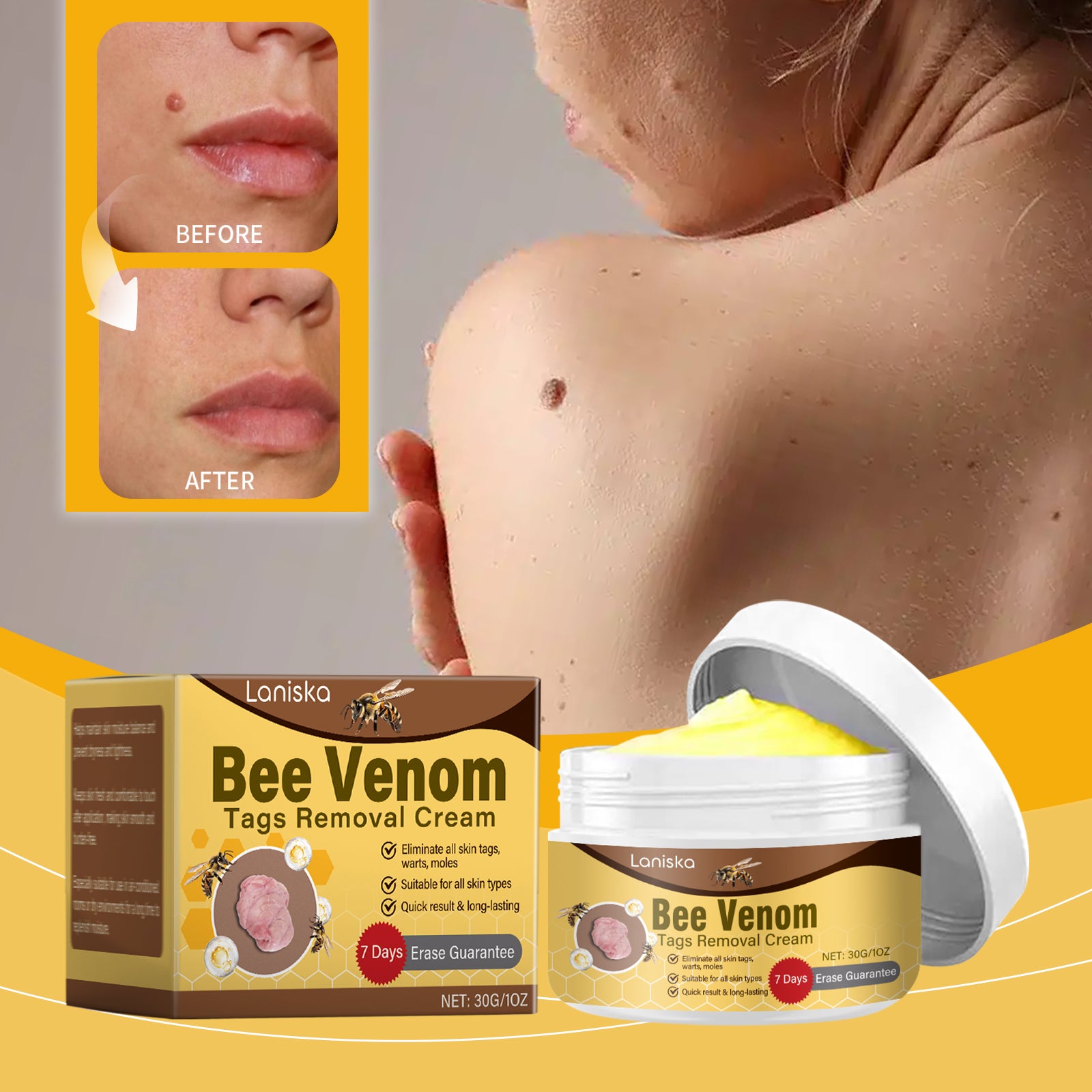 Laniska™ Bee Venom Comprehensive Cream – Dermatologist Recommended for Skin Care